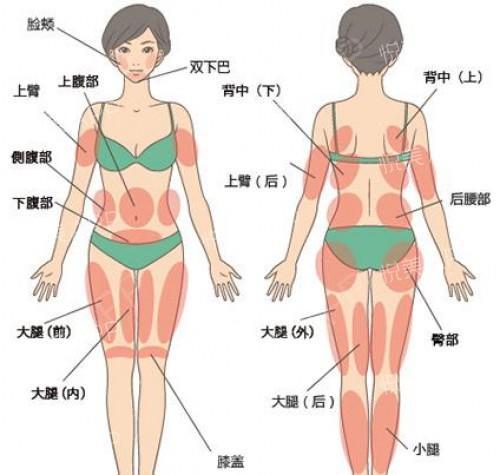 全身吸脂的常见部位有:面部,颈部,肩背,四肢,上下腹部,侧腰,臀部等.