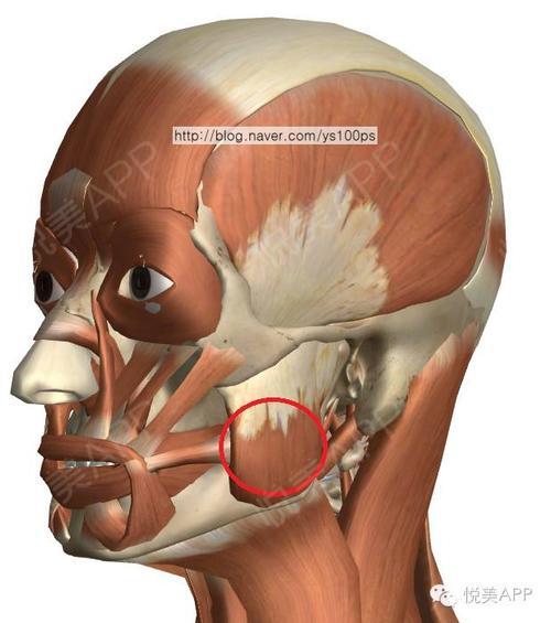 长期的进食咀嚼,咬肌的收缩对颧弓颧骨下方施加持续的张力,是造成颧弓