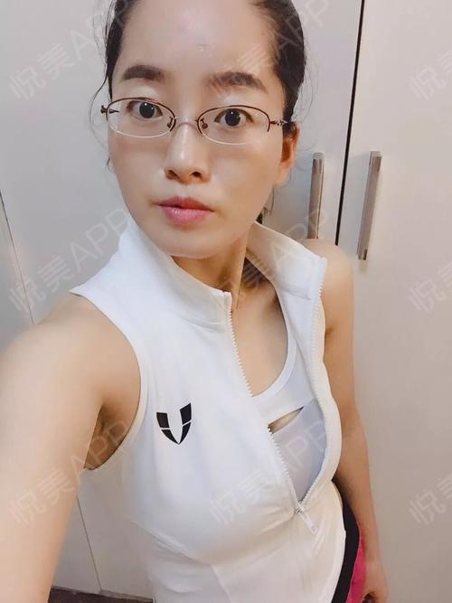 女性私密术后46天_私密整形术后46天_流水话分享图片1