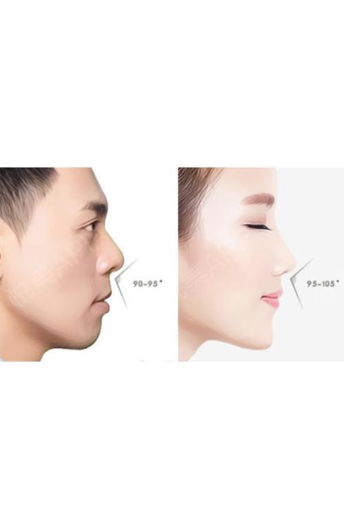 鼻唇角角度对鼻型的影响