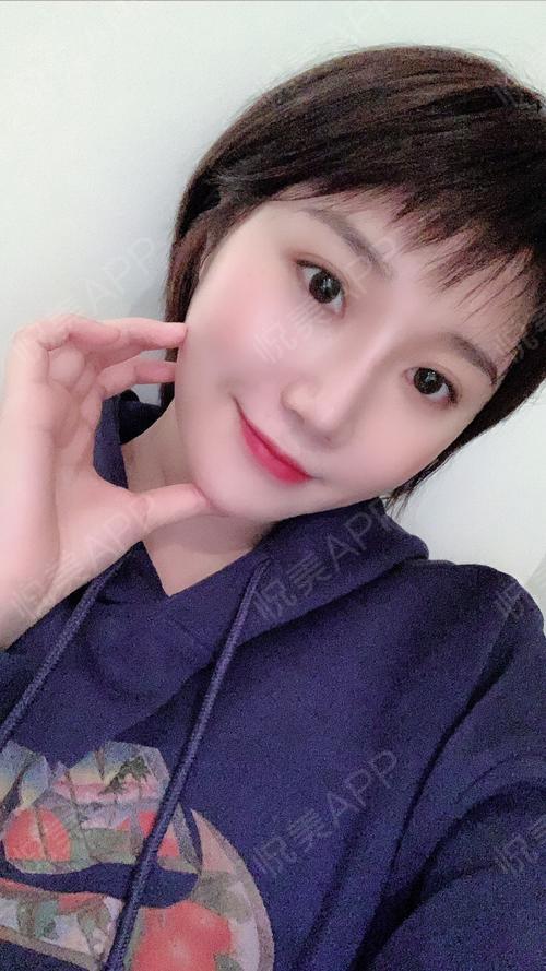 后576天_鼻部整形术后576天_颜值精选术后576天_天使爱美丽1分享图片6