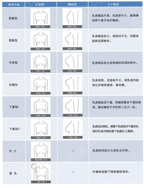 半球型:乳房的半径与高度相等,东方女性以圆盘形和半球形居多.