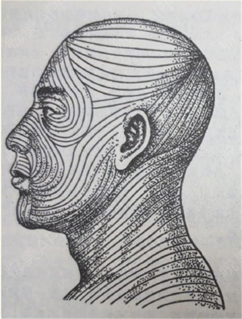 东方曲线双眼皮手术的解剖学原理与美学设计