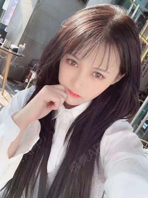 眼角术后52天_双眼皮术后52天_眼部整形术后52天_小老婆桂哥分享图片2