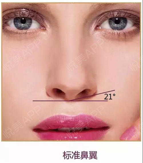 正常形态为球形,鼻尖与鼻孔比例为1:2.