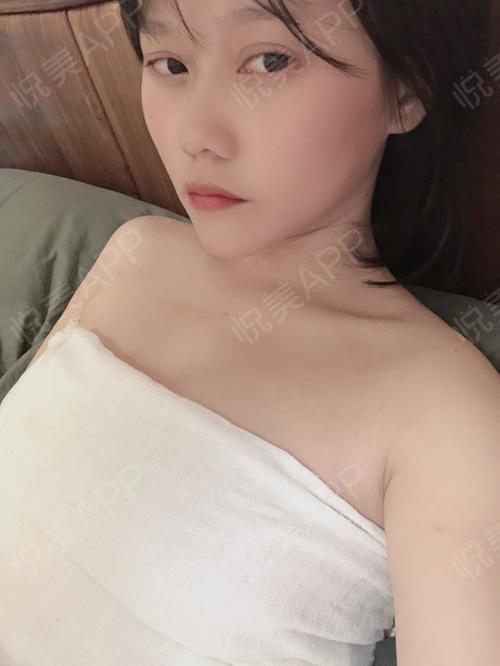 假体隆胸术后7天_隆胸术后7天_胸部整形术后7天_悦mer_0659955424分享