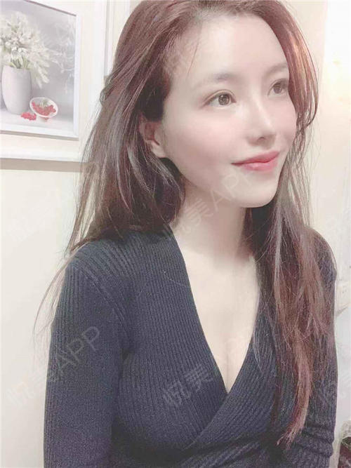 脂肪隆胸术后189天_形体填充术后189天_胸型美化术后189天_乳头&乳晕