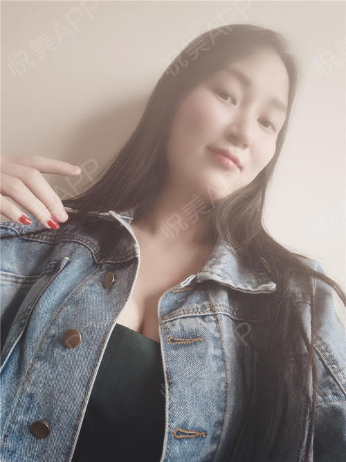 假体隆胸术后236天_隆胸术后236天_胸部整形术后236天_my own way分享