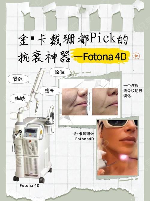 卡戴珊推荐的fotona4d欧洲之星究竟是什么71