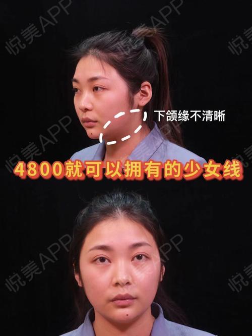 4800就可以拥有的少女线